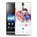 Дизайнерский пластиковый чехол для Sony Xperia S