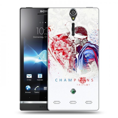 Дизайнерский пластиковый чехол для Sony Xperia S