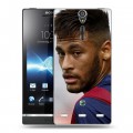 Дизайнерский пластиковый чехол для Sony Xperia S