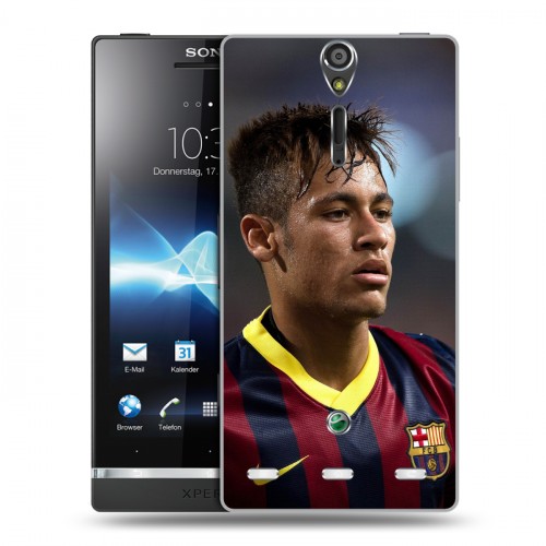 Дизайнерский пластиковый чехол для Sony Xperia S