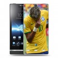 Дизайнерский пластиковый чехол для Sony Xperia S