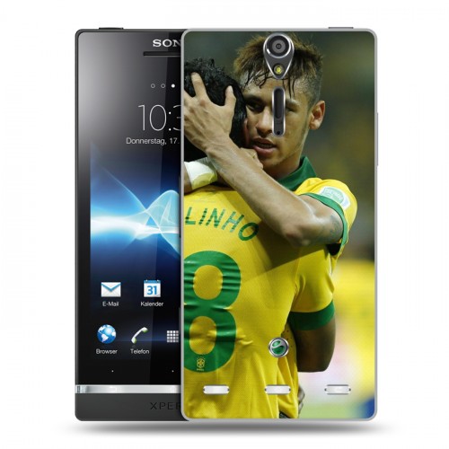 Дизайнерский пластиковый чехол для Sony Xperia S