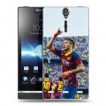 Дизайнерский пластиковый чехол для Sony Xperia S