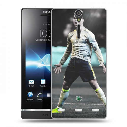 Дизайнерский пластиковый чехол для Sony Xperia S