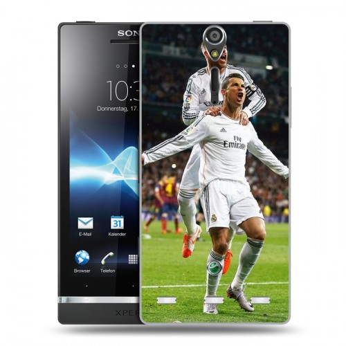 Дизайнерский пластиковый чехол для Sony Xperia S