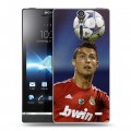 Дизайнерский пластиковый чехол для Sony Xperia S