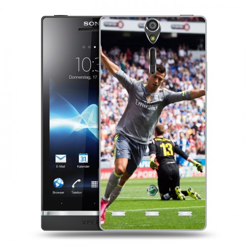 Дизайнерский пластиковый чехол для Sony Xperia S