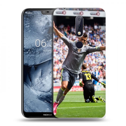 Дизайнерский пластиковый чехол для Nokia 6.1 Plus