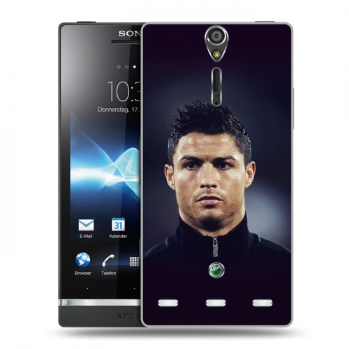 Дизайнерский пластиковый чехол для Sony Xperia S