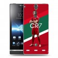 Дизайнерский пластиковый чехол для Sony Xperia S