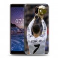 Дизайнерский пластиковый чехол для Nokia 7 Plus