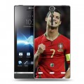 Дизайнерский пластиковый чехол для Sony Xperia S