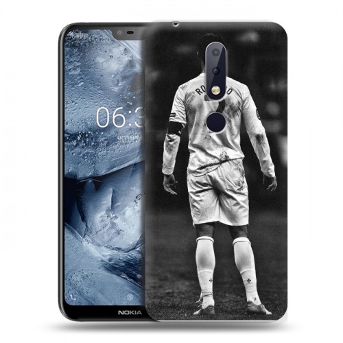 Дизайнерский пластиковый чехол для Nokia 6.1 Plus