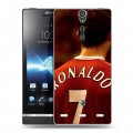 Дизайнерский пластиковый чехол для Sony Xperia S