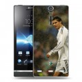 Дизайнерский пластиковый чехол для Sony Xperia S