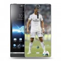 Дизайнерский пластиковый чехол для Sony Xperia S