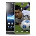 Дизайнерский пластиковый чехол для Sony Xperia S