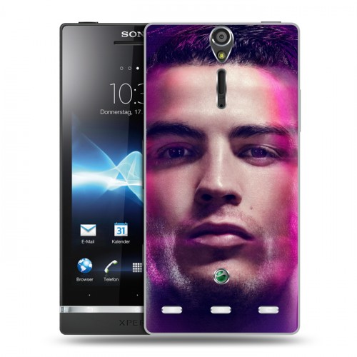 Дизайнерский пластиковый чехол для Sony Xperia S