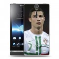 Дизайнерский пластиковый чехол для Sony Xperia S