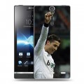 Дизайнерский пластиковый чехол для Sony Xperia S