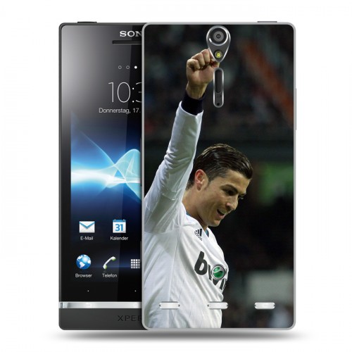 Дизайнерский пластиковый чехол для Sony Xperia S