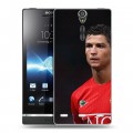 Дизайнерский пластиковый чехол для Sony Xperia S