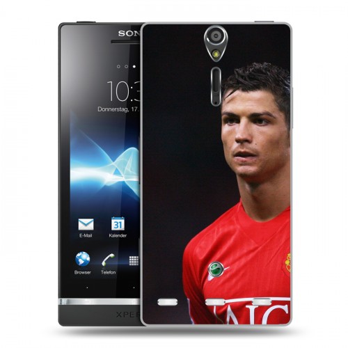 Дизайнерский пластиковый чехол для Sony Xperia S