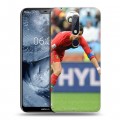 Дизайнерский пластиковый чехол для Nokia 6.1 Plus