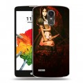 Дизайнерский пластиковый чехол для LG Stylus 3 Alice Madness Returns