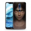 Дизайнерский пластиковый чехол для Nokia 5.1 Plus Alice Madness Returns