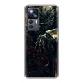 Дизайнерский силиконовый чехол для Xiaomi 12T Dark souls