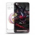 Дизайнерский пластиковый чехол для Xiaomi RedMi 5A Dota 2