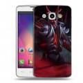 Дизайнерский пластиковый чехол для LG L60 Dota 2