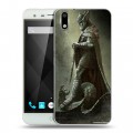 Дизайнерский пластиковый чехол для Ulefone Paris Skyrim