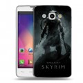 Дизайнерский пластиковый чехол для LG L60 Skyrim