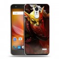 Дизайнерский пластиковый чехол для ZTE Blade X5 Dota 2