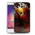 Дизайнерский пластиковый чехол для LG L60 Dota 2