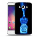 Дизайнерский пластиковый чехол для LG L60 Absolut