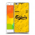 Дизайнерский силиконовый чехол для Xiaomi Mi Note Carlsberg