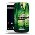 Дизайнерский пластиковый чехол для Doogee X6 Heineken