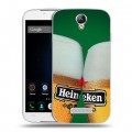 Дизайнерский пластиковый чехол для Doogee X6 Heineken