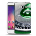 Дизайнерский пластиковый чехол для LG L60 Heineken