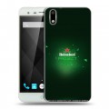 Дизайнерский пластиковый чехол для Ulefone Paris Heineken