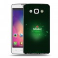 Дизайнерский пластиковый чехол для LG L60 Heineken