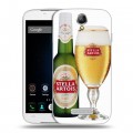 Дизайнерский пластиковый чехол для Doogee X6 Stella Artois