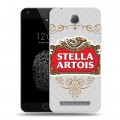 Дизайнерский пластиковый чехол для Umi Touch Stella Artois