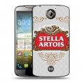 Дизайнерский пластиковый чехол для Acer Liquid S2 Stella Artois