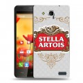 Дизайнерский пластиковый чехол для MTS 978 Stella Artois