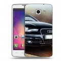 Дизайнерский пластиковый чехол для LG L60 Audi