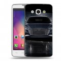 Дизайнерский пластиковый чехол для LG L60 Audi